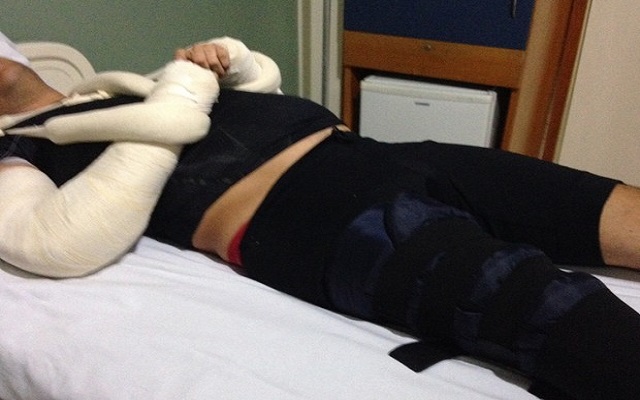 Ciclista quebrou dois os braços e uma perna durante assalto (Foto: Arquivo Pessoal)
